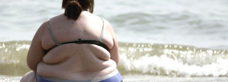 Noticia de Almera 24h: Obesidad y sobrepeso. Una acumulacin excesiva de grasa que puede ser perjudicial para la salud