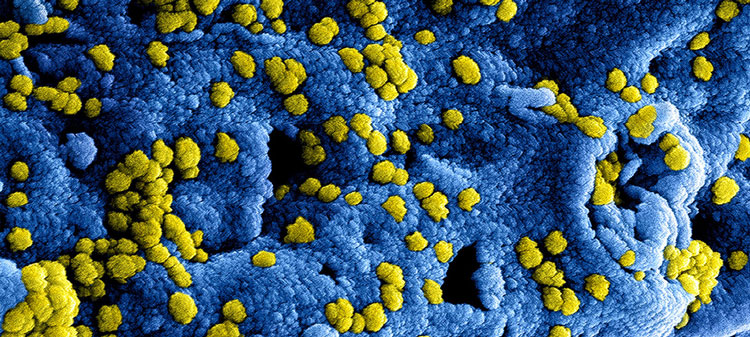 China confirma 41 casos de un nuevo coronavirus que ya se ha cobrado una vctima